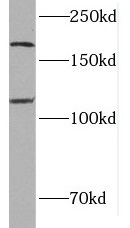 MTUS1 antibody|MTUS1抗体 FNab054