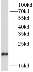 DYNLRB1 antibody|DYNLRB1抗体
