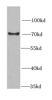 RBBP5 antibody|RBBP5抗体