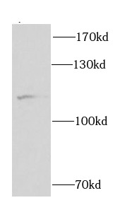 CUL4B antibody|CUL4B抗体 FNab020