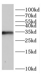 CCND2 antibody|CCND2抗体