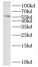 QRSL1 antibody|QRSL1抗体