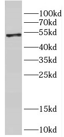 DPH2 antibody|DPH2抗体 FNab02517