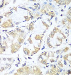 RPH3AL antibody|RPH3AL抗体
