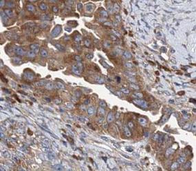 CTSB antibody|CTSB抗体 FNab01304