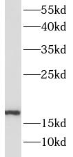 SOD1 antibody|SOD1抗体 FNab09989
