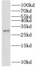 STOML3 antibody|STOML3抗体