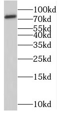 RNF6 antibody|RNF6抗体