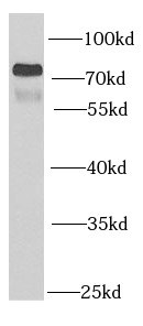 PSG1 antibody|PSG1抗体