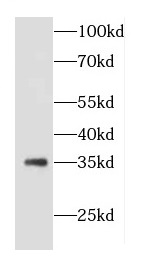 COQ5 antibody|COQ5抗体