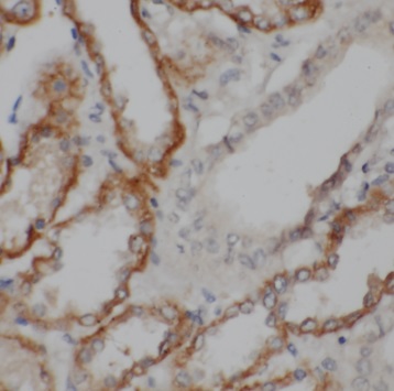 TSC22D2 antibody|TSC22D2抗体