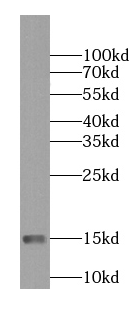 NDUFS5 antibody|NDUFS5抗体 FNab0