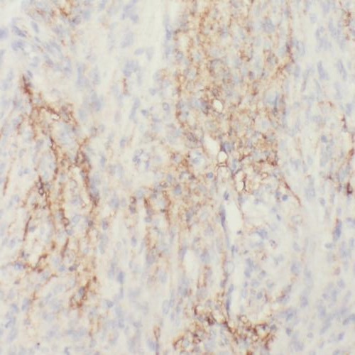 RIC8B antibody|RIC8B抗体