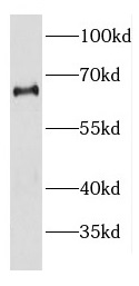 DDX56 antibody|DDX56抗体