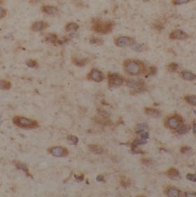 YWHAQ antibody|YWHAQ抗体 FNab000