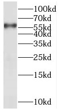 PPP3CC antibody|PPP3CC抗体 FNab0