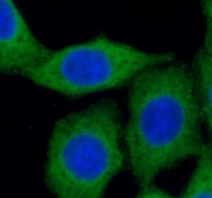 ATG12 antibody|ATG12抗体 FNab006