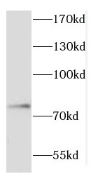 COIL antibody|COIL抗体
