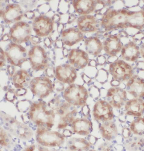 CDK14 antibody|CDK14抗体