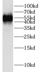 LCK antibody|LCK抗体 FNab04725
