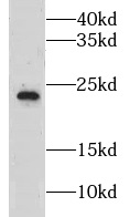 LZIC antibody|LZIC抗体