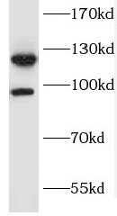 FGFR2 antibody|FGFR2抗体