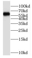 P4HA2 antibody|P4HA2抗体