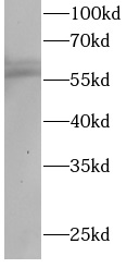 RORC antibody|RORC抗体 FNab10046