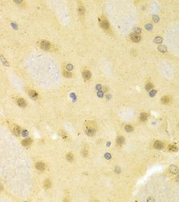 SMAD1 antibody|SMAD1抗体