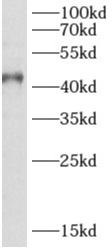 AIPL1 antibody|AIPL1抗体