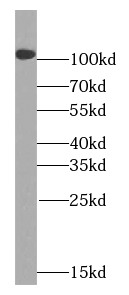 UNC5C-Specific antibody|UNC5C抗