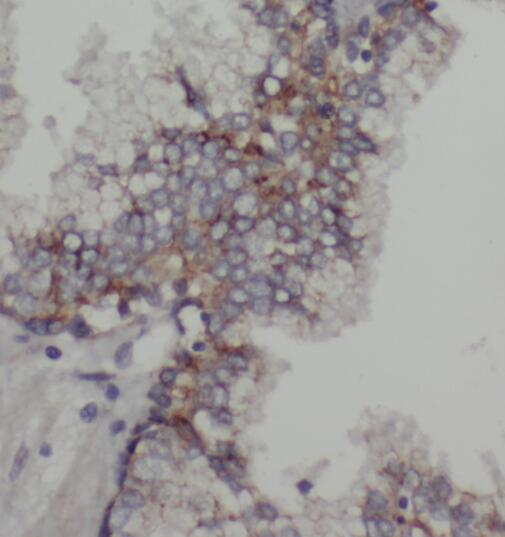 OXSR1 antibody|OXSR1抗体