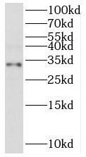 CLTRN antibody|CLTRN抗体 FNab087