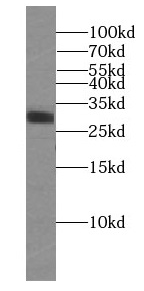 RIMS4-Specific antibody|RIMS4抗