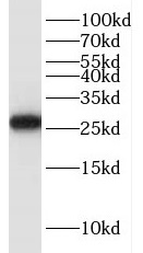 HELT antibody|HELT抗体