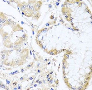 INPP5K antibody|INPP5K抗体