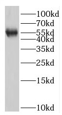 RNFT2 antibody|RNFT2抗体