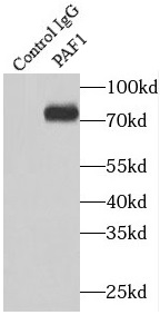 NOB1 antibody|NOB1抗体 FNab05777