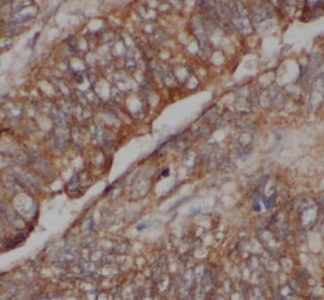 CARD11 antibody|CARD11抗体