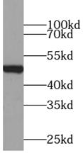 ZRANB2 antibody|ZRANB2抗体