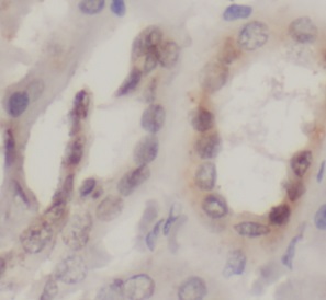 PTGER3 antibody|PTGER3抗体 FNab1
