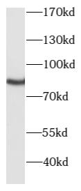 PRKCG antibody|PRKCG抗体 FNab100