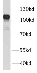 BCL11B antibody|BCL11B抗体