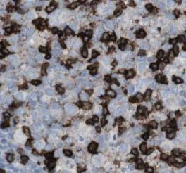 ITGB7 antibody|ITGB7抗体