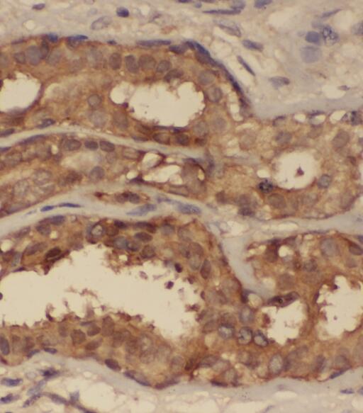 SNRPG antibody|SNRPG抗体