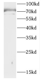 CCDC28A antibody|CCDC28A抗体