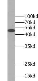 WIPF2 antibody|WIPF2抗体