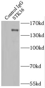 SMAD5 antibody|SMAD5抗体