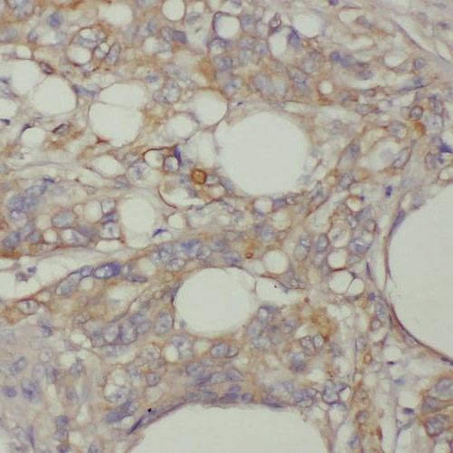 TMEM9B antibody|TMEM9B抗体