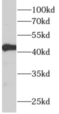 ALDH3B2 antibody|ALDH3B2抗体